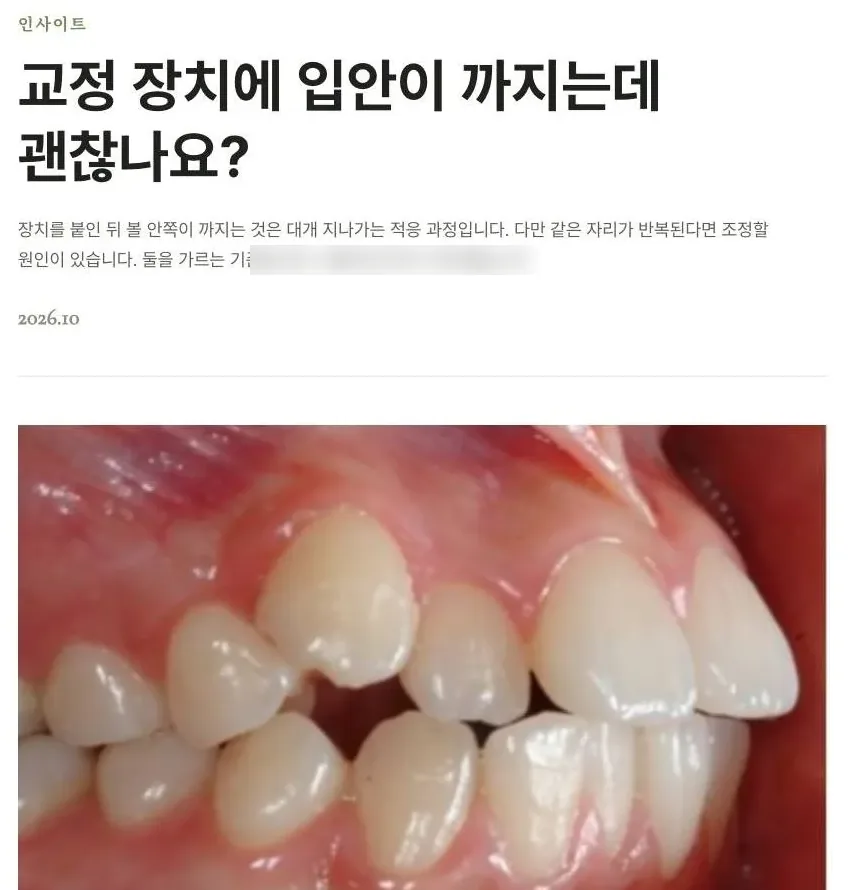 글 본문 · 첫 문단에서 답을 먼저 말해요